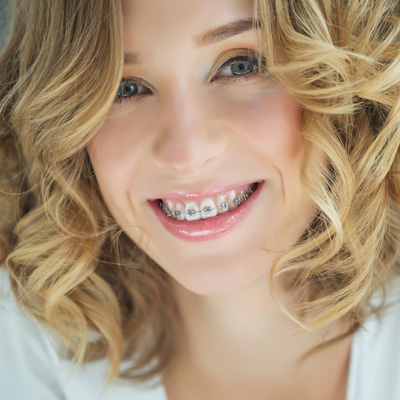 Woodburn Family Dentistry | Crowns  amp  Caps, Root Canals and Veneers
